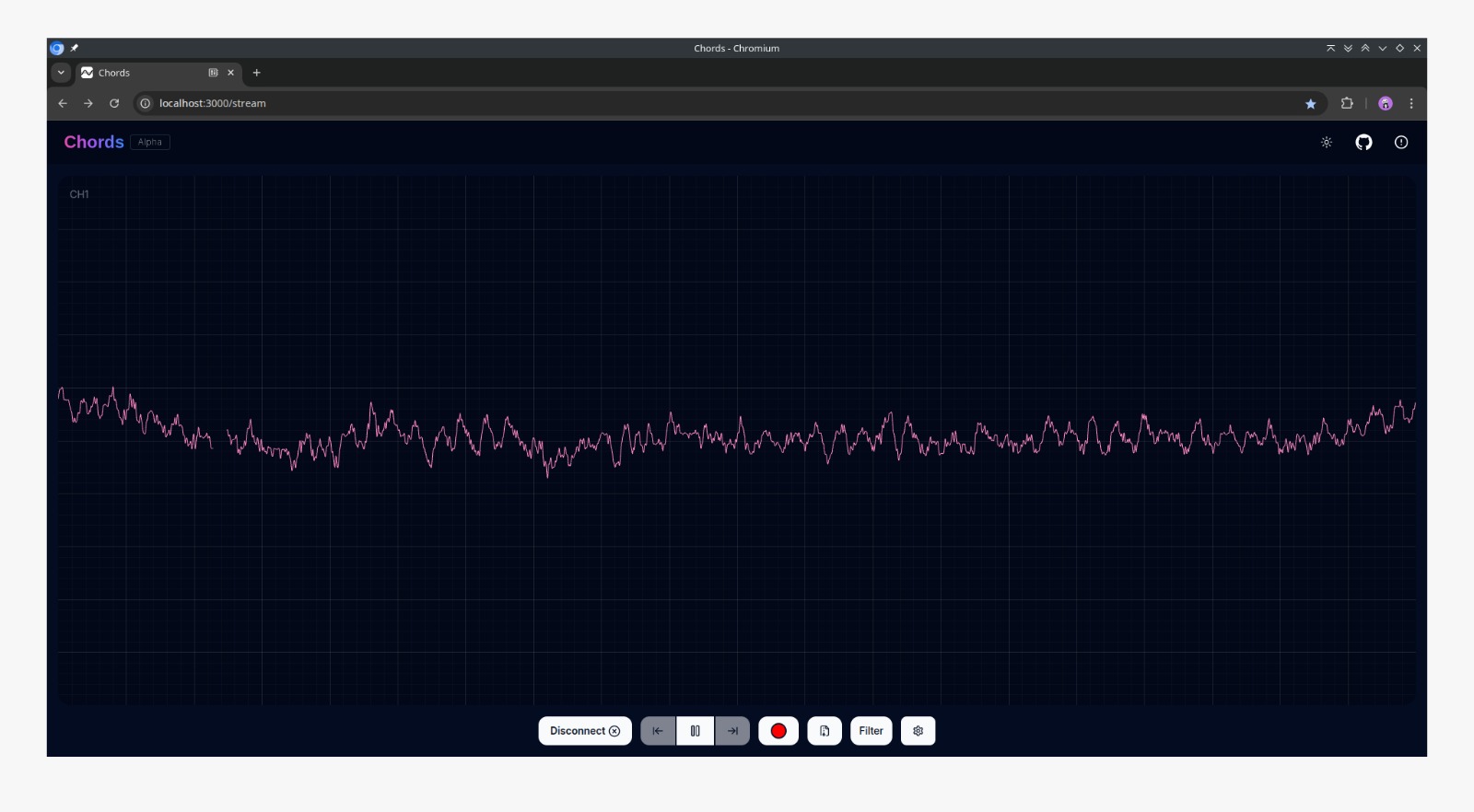 Alpha waves EEG