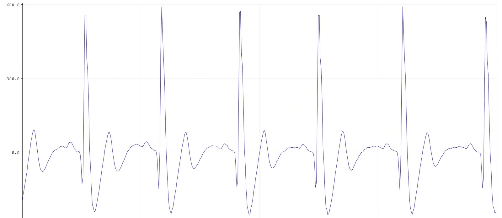 Visualizing ECG signals on Arduino IDE v1.8.x