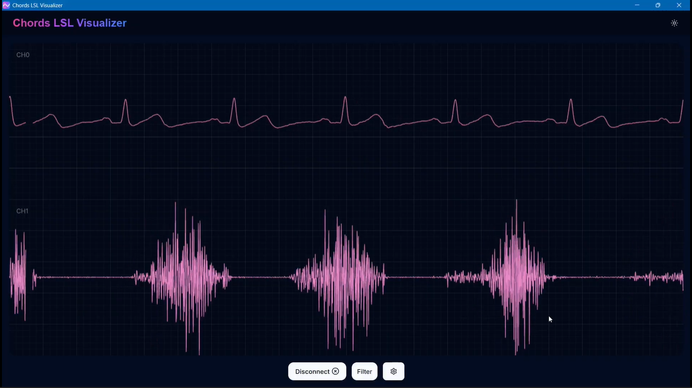 Chords LSL Visualizer Landing Page