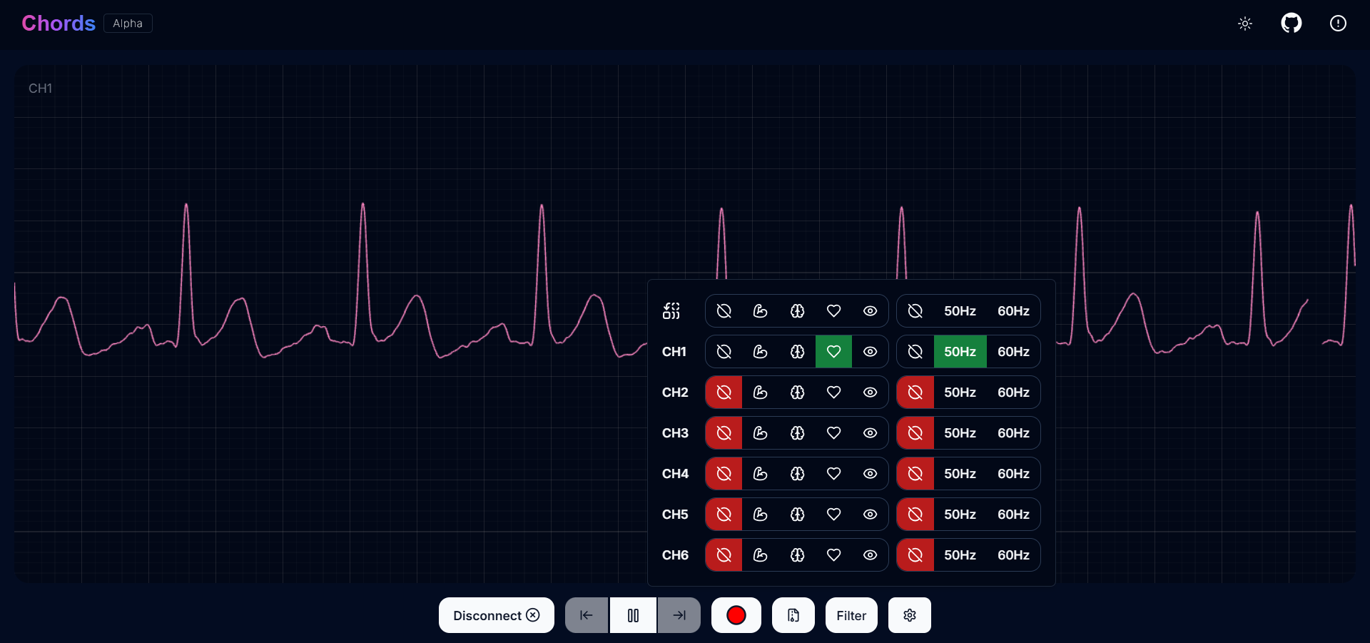 Visualizing ECG signals on Chords Web