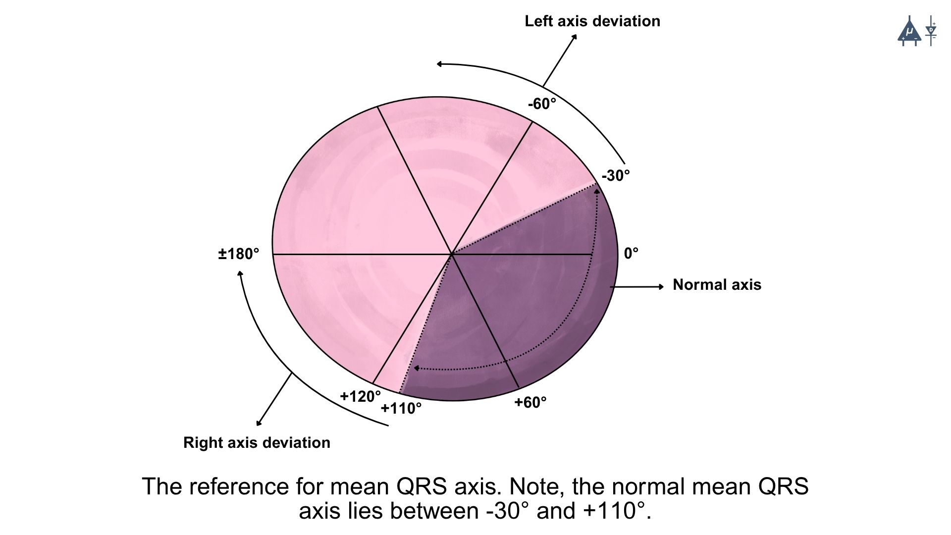 Cardiac Axis Deviation