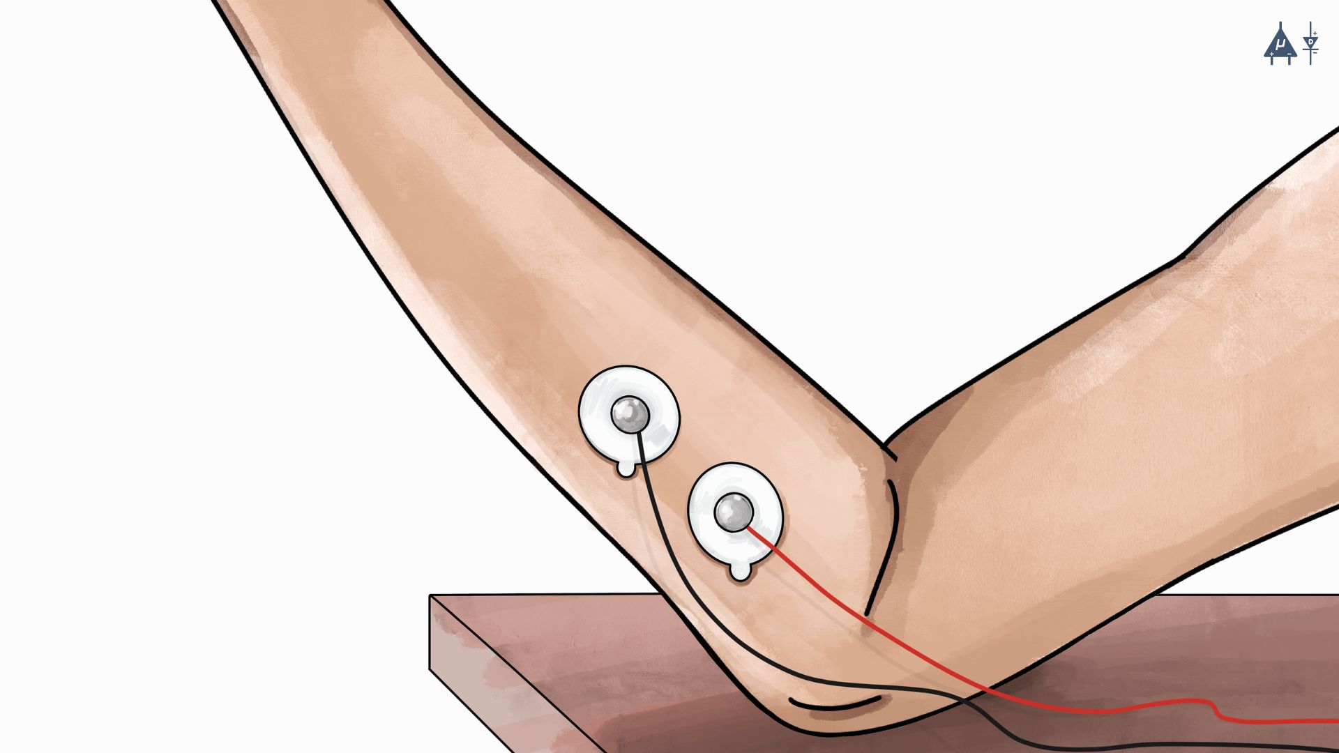 EMG Gel Electrode Placement