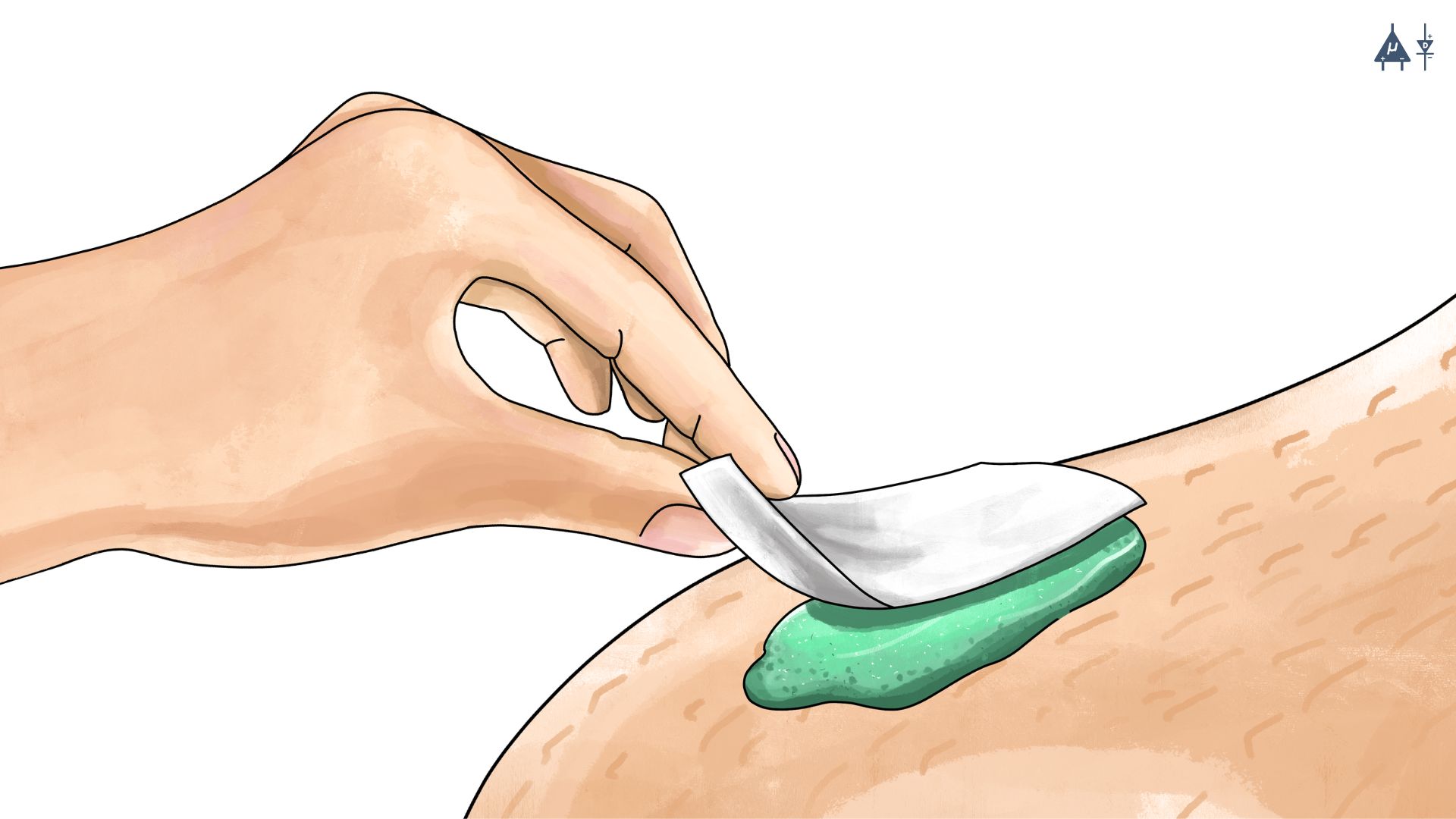 Wipe away excess gel