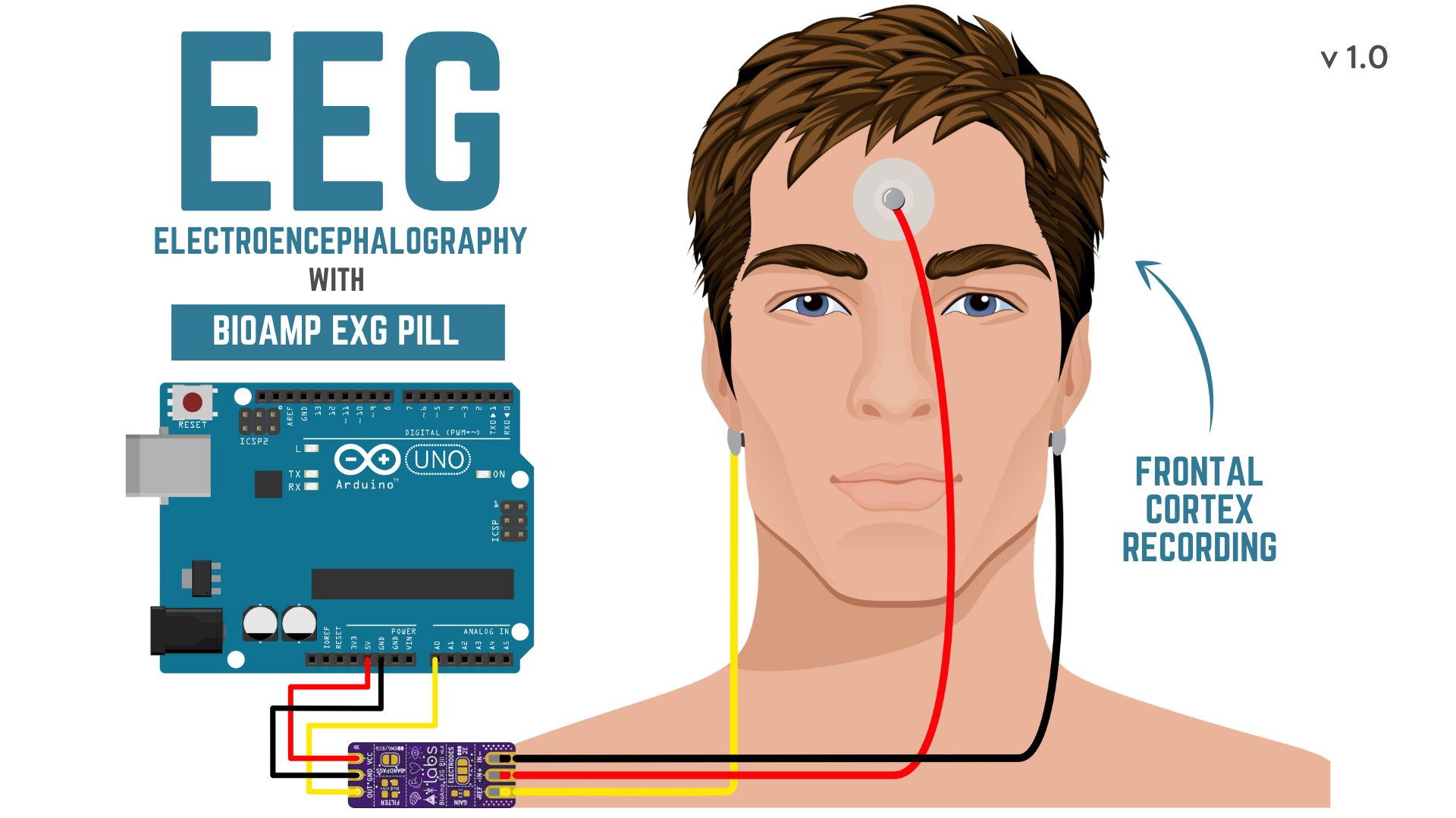 EEG gel electrode placement