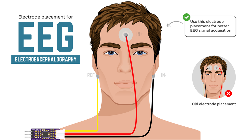 Electrode placement for EEG