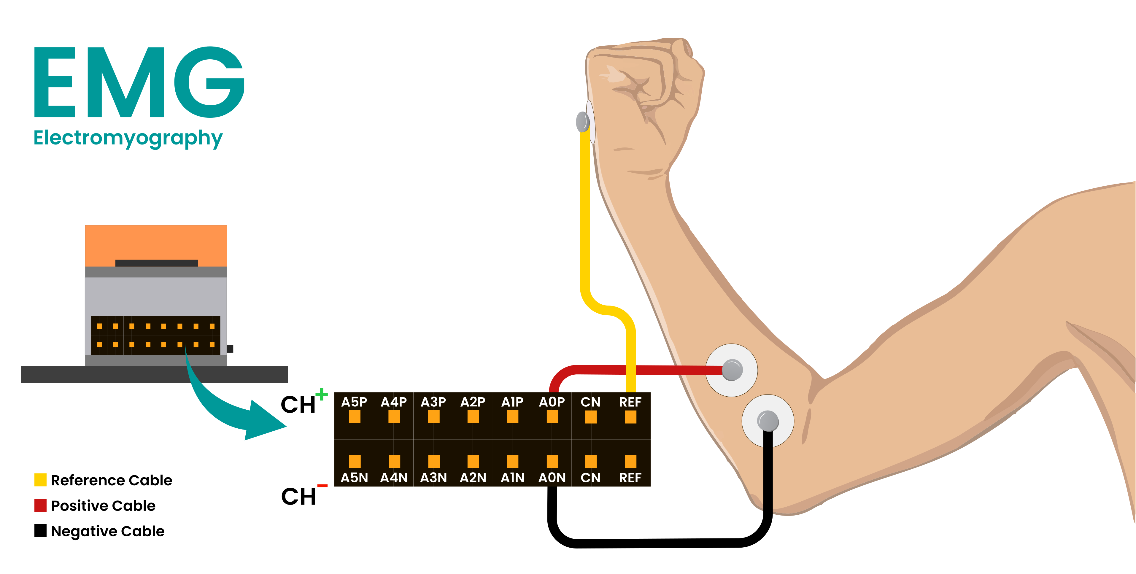 Connection for EMG
